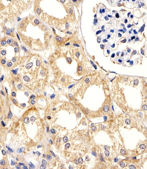 UBE2L3 / UBCH7 Antibody - Immunohistochemical of paraffin-embedded H.kidney section using UBE2L3 Antibody. Antibody was diluted at 1:25 dilution. A peroxidase-conjugated goat anti-rabbit IgG at 1:400 dilution was used as the secondary antibody, followed by DAB staining.