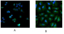 UBE2L3 / UBCH7 Antibody - Immunofluorescence staining of MCF7 (A) and HeLa (B) cells with 5ug/ml antibody. Detected with Rabbit anti-goat IgG-Alexafluor488 antibody at 1:1000. Nuclei Counterstained with DAPI.