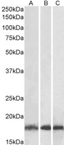 UBE2L3 / UBCH7 Antibody - Goat Anti-UBE2L3 Antibody (0.03µg/ml) staining of Human (A), Mouse (B) and Rat (C) Skeletal Muscle lysates (35µg protein in RIPA buffer). Primary incubation was 1 hour. Detected by chemiluminescencence.