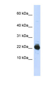UBE2L3 / UBCH7 Antibody - UBE2L3 antibody Western blot of Transfected 293T cell lysate. This image was taken for the unconjugated form of this product. Other forms have not been tested.
