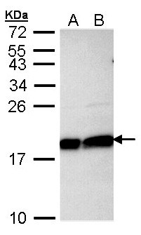 UBE2L3 / UBCH7 Antibody - Sample (30 ug of whole cell lysate). A: Hela, B: Hep G2 . 12% SDS PAGE. UBCH7 antibody diluted at 1:1000.