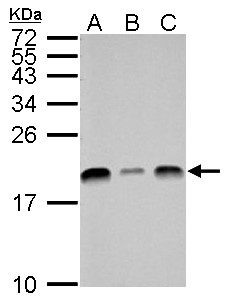 UBE2L3 / UBCH7 Antibody - UBE2L3 antibody detects UBE2L3 protein by Western blot analysis. A. 30 ug Neuro2A whole cell lysate/extract. B. 30 ug GL261 whole cell lysate/extract. C. 30 ug C8D30 whole cell lysate/extract. 15 % SDS-PAGE. UBE2L3 antibody dilution:1:1000
