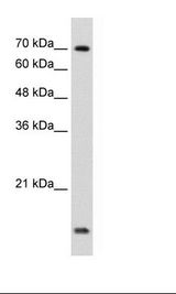 UBE2L3 / UBCH7 Antibody - Jurkat Cell Lysate.  This image was taken for the unconjugated form of this product. Other forms have not been tested.