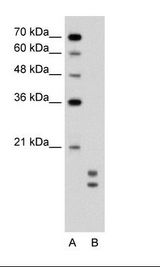 UBE2L3 / UBCH7 Antibody - A: Marker, B: Jurkat Cell Lysate.  This image was taken for the unconjugated form of this product. Other forms have not been tested.