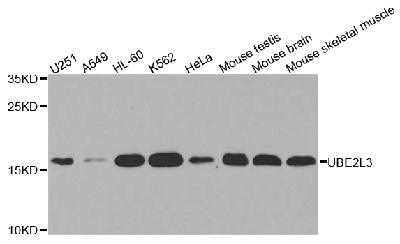 UBE2L3 / UBCH7 Antibody - Western blot analysis of extracts of various cell lines.