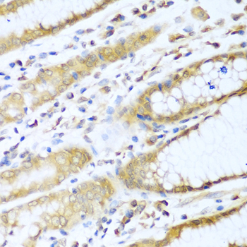 UBE2L3 / UBCH7 Antibody - Immunohistochemistry of paraffin-embedded human stomach tissue.