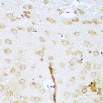 UBE2L3 / UBCH7 Antibody - Immunohistochemistry of paraffin-embedded mouse brain tissue.