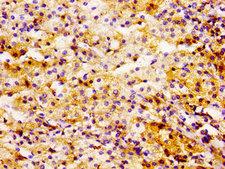 UBE2L3 / UBCH7 Antibody - Immunohistochemistry image of paraffin-embedded human adrenal gland tissue at a dilution of 1:100