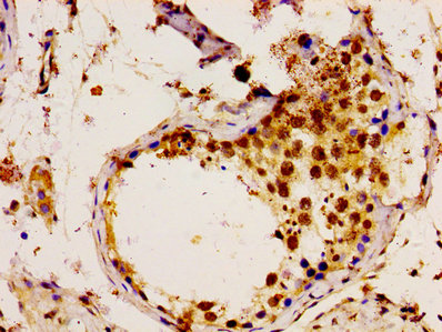 UBE2L3 / UBCH7 Antibody - Immunohistochemistry image of paraffin-embedded human testis tissue at a dilution of 1:100