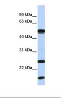 UBE2L6 Antibody - MCF7 cell lysate. Antibody concentration: 1.0 ug/ml. Gel concentration: 12%.  This image was taken for the unconjugated form of this product. Other forms have not been tested.