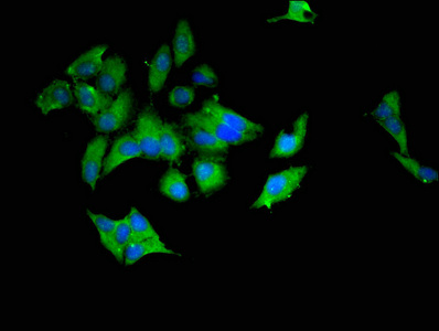 UBE2L6 Antibody - Immunofluorescent analysis of Hela cells at a dilution of 1:100 and Alexa Fluor 488-congugated AffiniPure Goat Anti-Rabbit IgG(H+L)