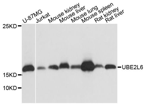 UBE2L6 Antibody - Western blot analysis of extracts of various cell lines, using UBE2L6 antibody at 1:1000 dilution. The secondary antibody used was an HRP Goat Anti-Rabbit IgG (H+L) at 1:10000 dilution. Lysates were loaded 25ug per lane and 3% nonfat dry milk in TBST was used for blocking. An ECL Kit was used for detection and the exposure time was 5s.
