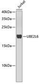 UBE2L6 Antibody - Western blot analysis of extracts of Jurkat cells using UBE2L6 Polyclonal Antibody.