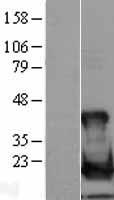 UBE2L6 Protein - Western validation with an anti-DDK antibody * L: Control HEK293 lysate R: Over-expression lysate