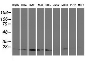 UBE2M / UBC12 Antibody - Western blot of extracts (35ug) from 9 different cell lines by using anti-UBE2M monoclonal antibody.