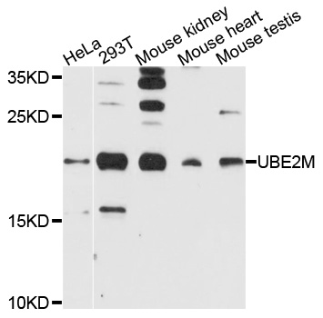 UBE2M / UBC12 Antibody - Western blot analysis of extracts of various cells.