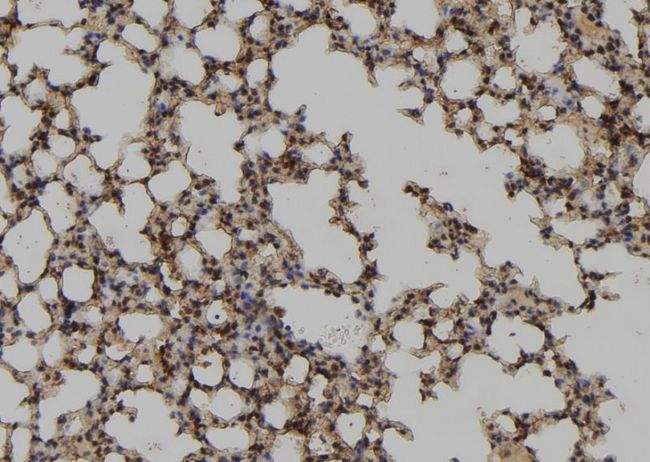 UBE2M / UBC12 Antibody - 1:100 staining mouse lung tissue by IHC-P. The sample was formaldehyde fixed and a heat mediated antigen retrieval step in citrate buffer was performed. The sample was then blocked and incubated with the antibody for 1.5 hours at 22°C. An HRP conjugated goat anti-rabbit antibody was used as the secondary.