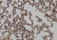 UBE2M / UBC12 Antibody - 1:100 staining mouse lung tissue by IHC-P. The sample was formaldehyde fixed and a heat mediated antigen retrieval step in citrate buffer was performed. The sample was then blocked and incubated with the antibody for 1.5 hours at 22°C. An HRP conjugated goat anti-rabbit antibody was used as the secondary.