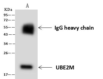 UBE2M / UBC12 Antibody - UBE2M was immunoprecipitated using: Lane A: 0.5 mg HEK-293 Whole Cell Lysate. 4 uL anti-UBE2M rabbit polyclonal antibody and 60 ug of Immunomagnetic beads Protein A/G. Primary antibody: Anti-UBE2M rabbit polyclonal antibody, at 1:100 dilution. Secondary antibody: Goat Anti-Rabbit IgG (H+L)/HRP at 1/10000 dilution. Developed using the ECL technique. Performed under reducing conditions. Predicted band size: 21 kDa. Observed band size: 21 kDa.