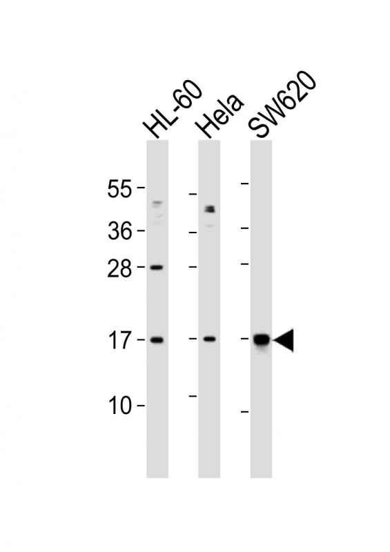 UBE2N / UBC13 Antibody - All lanes : Anti-UBE2N Antibody at 1:1000 dilution Lane 1: HL-60 whole cell lysates Lane 2: HeLa whole cell lysates Lane 3: SW620 whole cell lysates Lysates/proteins at 20 ug per lane. Secondary Goat Anti-Rabbit IgG, (H+L), Peroxidase conjugated at 1/10000 dilution Predicted band size : 17 kDa Blocking/Dilution buffer: 5% NFDM/TBST.
