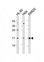 UBE2N / UBC13 Antibody - All lanes : Anti-UBE2N Antibody at 1:1000 dilution Lane 1: HL-60 whole cell lysates Lane 2: HeLa whole cell lysates Lane 3: SW620 whole cell lysates Lysates/proteins at 20 ug per lane. Secondary Goat Anti-Rabbit IgG, (H+L), Peroxidase conjugated at 1/10000 dilution Predicted band size : 17 kDa Blocking/Dilution buffer: 5% NFDM/TBST.