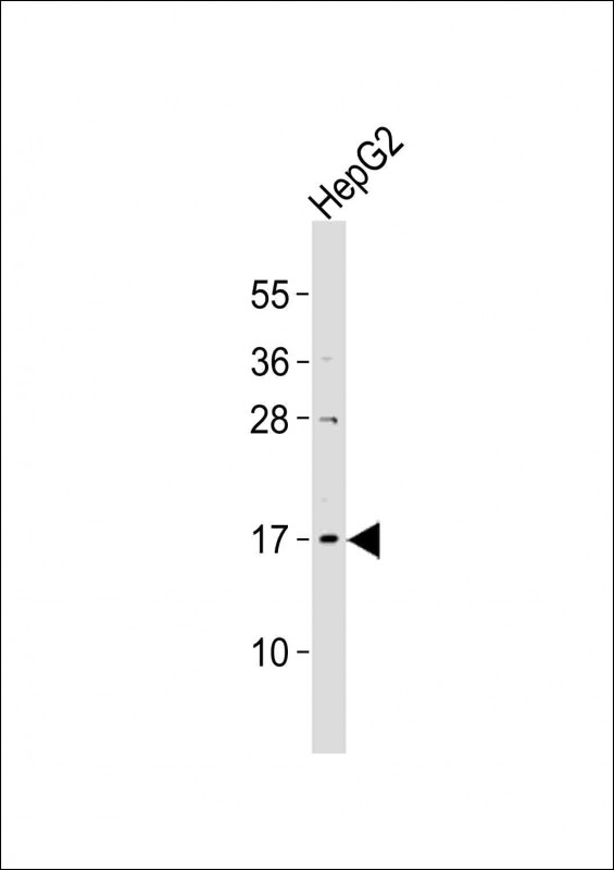 UBE2N / UBC13 Antibody - Anti-UBE2N Antibody at 1:2000 dilution + HepG2 whole cell lysates Lysates/proteins at 20 ug per lane. Secondary Goat Anti-Rabbit IgG, (H+L), Peroxidase conjugated at 1/10000 dilution Predicted band size :17 kDa Blocking/Dilution buffer: 5% NFDM/TBST.