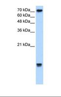 UBE2N / UBC13 Antibody - Jurkat cell lysate. Antibody concentration: 2.5 ug/ml. Gel concentration: 15%.  This image was taken for the unconjugated form of this product. Other forms have not been tested.