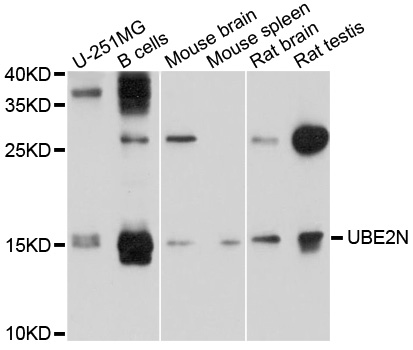 UBE2N / UBC13 Antibody - Western blot analysis of extracts of various cell lines, using UBE2N antibody at 1:1000 dilution. The secondary antibody used was an HRP Goat Anti-Rabbit IgG (H+L) at 1:10000 dilution. Lysates were loaded 25ug per lane and 3% nonfat dry milk in TBST was used for blocking. An ECL Kit was used for detection and the exposure time was 15s.