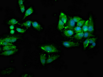 UBE2N / UBC13 Antibody - Immunofluorescence staining of Hela cells at a dilution of 1:66, counter-stained with DAPI. The cells were fixed in 4% formaldehyde, permeabilized using 0.2% Triton X-100 and blocked in 10% normal Goat Serum. The cells were then incubated with the antibody overnight at 4 °C.The secondary antibody was Alexa Fluor 488-congugated AffiniPure Goat Anti-Rabbit IgG (H+L) .