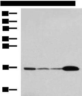UBE2N / UBC13 Antibody - Western blot analysis of Mouse brain tissue Hela cell LNCAP cell HepG2 cell Jurkat cell lysates  using UBE2N Polyclonal Antibody at dilution of 1:800