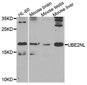 UBE2NL Antibody - Western blot analysis of extracts of various cell lines.