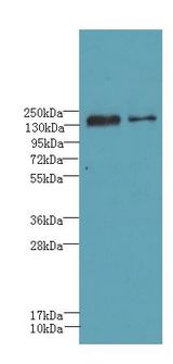 UBE2O Antibody - Western blot. All lanes: UBE2O antibody at 0.8 ug/ml. Lane 1: HeLa whole cell lysate. Lane 2: A431 whole cell lysate. Secondary Goat polyclonal to Rabbit IgG at 1:10000 dilution. Predicted band size: 141 kDa. Observed band size: 141 kDa.