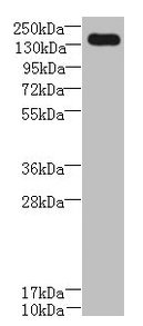 UBE2O Antibody - Western blot All lanes: UBE2O antibody at 0.8µg/ml + A431 whole cell lysate Secondary Goat polyclonal to rabbit IgG at 1/10000 dilution Predicted band size: 142 kDa Observed band size: 142 kDa
