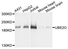 UBE2O Antibody - Western blot analysis of extracts of various cell lines, using UBE2O antibody at 1:1000 dilution. The secondary antibody used was an HRP Goat Anti-Rabbit IgG (H+L) at 1:10000 dilution. Lysates were loaded 25ug per lane and 3% nonfat dry milk in TBST was used for blocking. An ECL Kit was used for detection and the exposure time was 1s.