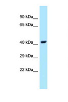 UBE2Q1 Antibody - UBE2Q1 antibody Western blot of Fetal Lung lysate. Antibody concentration 1 ug/ml.  This image was taken for the unconjugated form of this product. Other forms have not been tested.