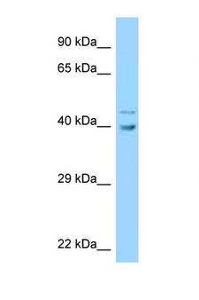 UBE2Q1 Antibody - UBE2Q1 antibody Western blot of HCT15 Cell lysate. Antibody concentration 1 ug/ml.  This image was taken for the unconjugated form of this product. Other forms have not been tested.