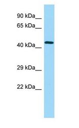 UBE2Q2 Antibody - UBE2Q2 antibody Western Blot of Fetal Heart.  This image was taken for the unconjugated form of this product. Other forms have not been tested.