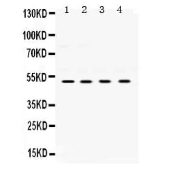 UBE2Q2 Antibody - UBE2Q2 antibody Western blot. All lanes: Anti UBE2Q2 at 0.5 ug/ml. Lane 1: HELA Whole Cell Lysate at 40 ug. Lane 2: A431 Whole Cell Lysate at 40 ug. Lane 3: MCF-7 Whole Cell Lysate at 40 ug. Lane 4: SW620 Whole Cell Lysate at 40 ug. Predicted band size: 50 kD. Observed band size: 50 kD.