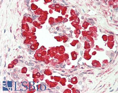 UBE2Q2 Antibody - Human Prostate: Formalin-Fixed, Paraffin-Embedded (FFPE).  This image was taken for the unconjugated form of this product. Other forms have not been tested.