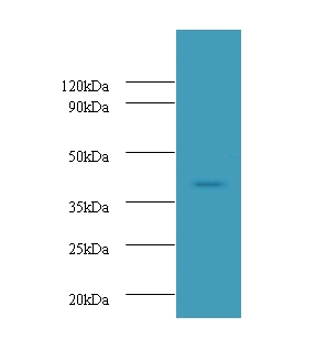 UBE2Q2 Antibody - Western blot of Ubiquitin-conjugating enzyme E2 Q2 Antibody at 2 ug/ml with A431 whole cell lysate. Secondary: Goat polyclonal to Rabbit IgG at 1:10000 dilution. Predicted band size: 43 KDa. Observed band size: 43 KDa.  This image was taken for the unconjugated form of this product. Other forms have not been tested.