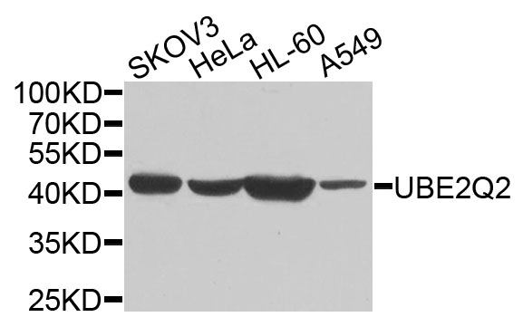 UBE2Q2 Antibody - Western blot analysis of extracts of various cells.