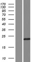 UBE2QL1 Protein - Western validation with an anti-DDK antibody * L: Control HEK293 lysate R: Over-expression lysate