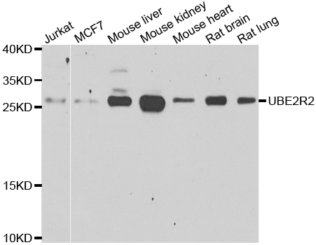 UBE2R2 Antibody - Western blot analysis of extracts of various cell lines.