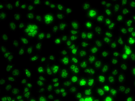 UBE2R2 Antibody - Immunofluorescence analysis of A549 cells.