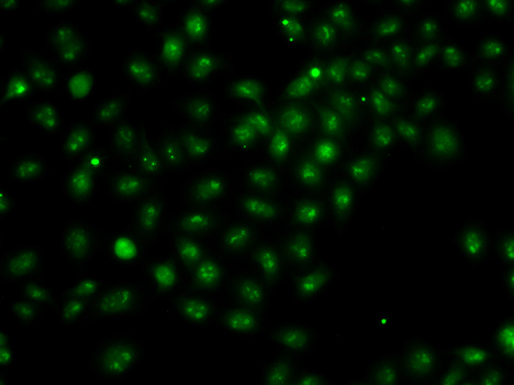 UBE2R2 Antibody - Immunofluorescence analysis of A549 cells.