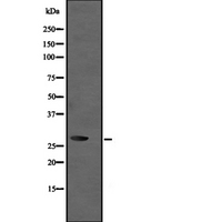 UBE2R2 Antibody - Western blot analysis of UBE2R2 expression in Jurkat whole cells lysate. The lane on the left is treated with the antigen-specific peptide.