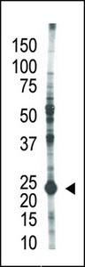 UBE2S / E2 EPF Antibody - The anti-E2EPF antibody is used in Western blot to detect E2EPF in HL-60 cell lysate.