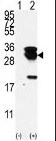 UBE2S / E2 EPF Antibody - Western blot of E2EPF (arrow) using E2EPF Antibody. 293 cell lysates (2 ug/lane) either nontransfected (Lane 1) or transiently transfected with the UBE2S gene (Lane 2) (Origene Technologies).