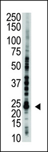 UBE2S / E2 EPF Antibody - The anti-E2EPF antibody is used in Western blot to detect E2EPF in Jurkat cell lysate.