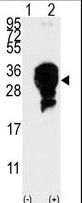 UBE2S / E2 EPF Antibody - Western blot of E2EPF (arrow) using E2EPF Antibody. 293 cell lysates (2 ug/lane) either nontransfected (Lane 1) or transiently transfected with the E2EPF gene (Lane 2) (Origene Technologies).